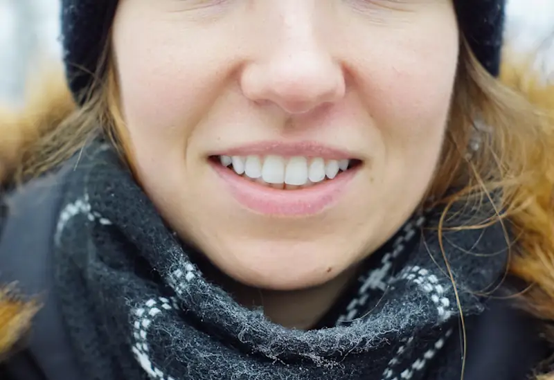 Woman smiling outdoors showing white teeth
