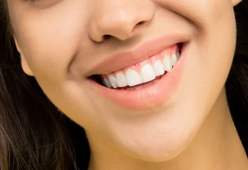 Close-up of a person smiling with naturally white teeth.